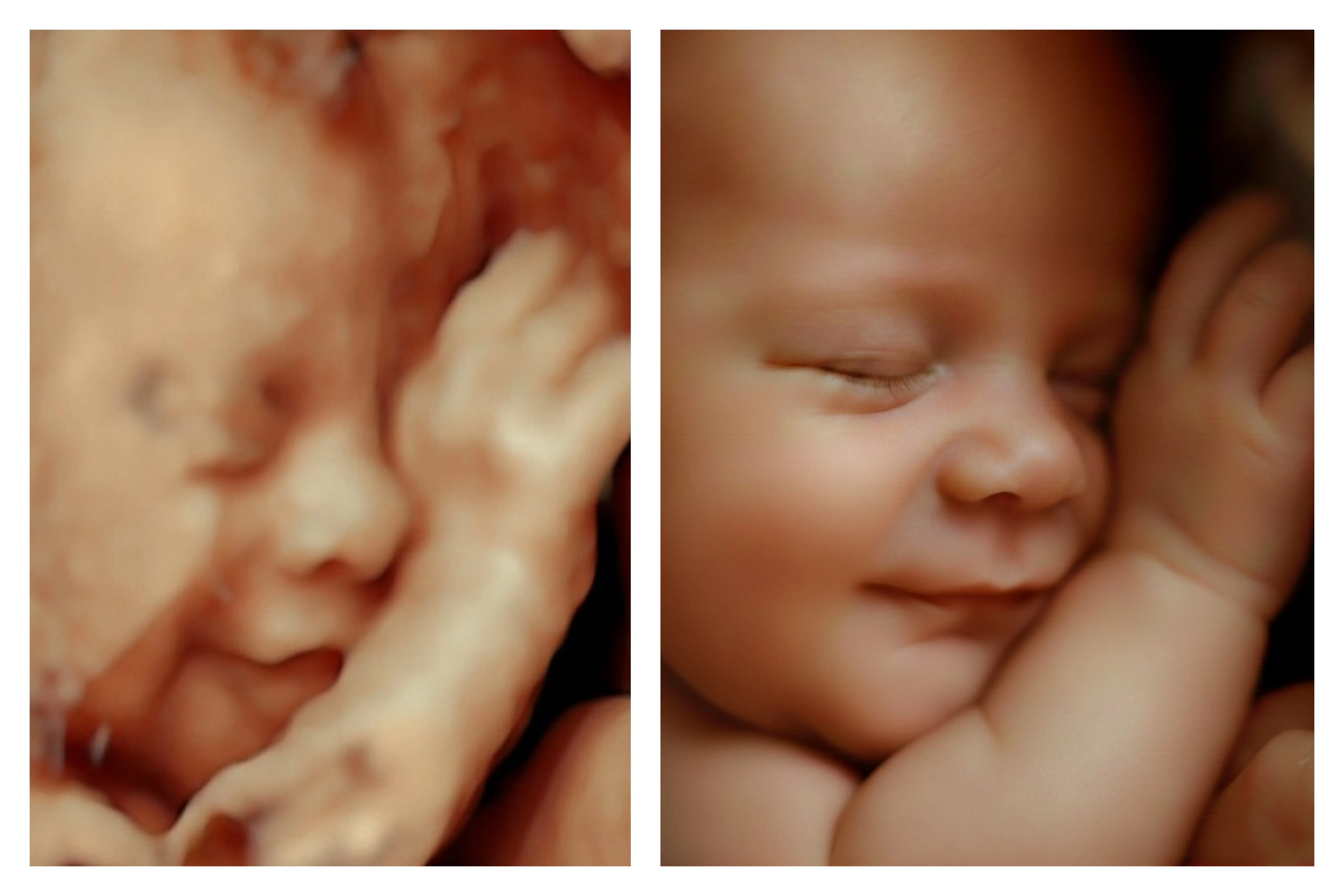 Ecografía 8K HD procesada con IA - Econatal Galicia Baleares