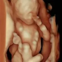 Bebé en ecografía 5D 8K HD - Econatal