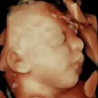 Ecografía 5D en Galicia - imagen real de sesión Econatal